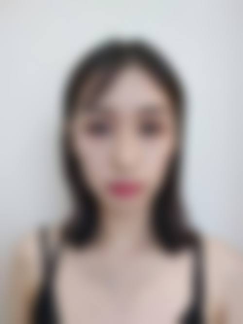 四、天津尔湾整形医院特色项目