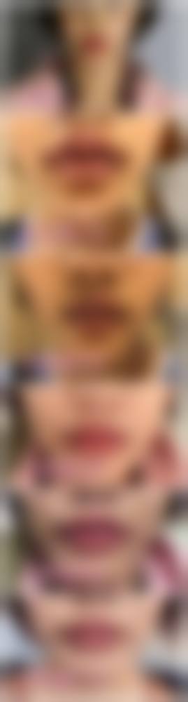 八、长春艾尔丽医疗美容真实的患者评价