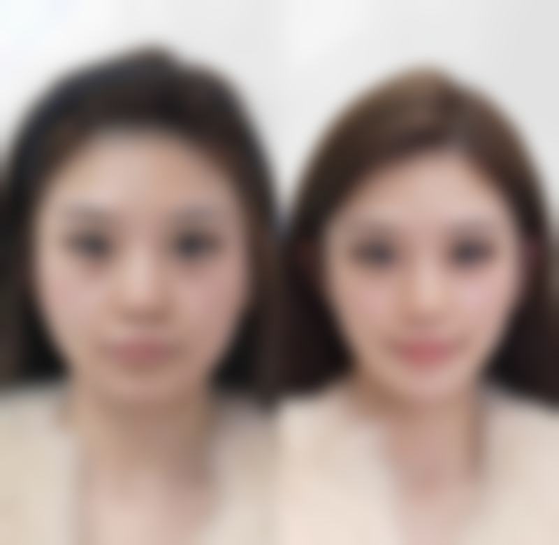 八、成都艺美汇整形医疗美容医院预约方式