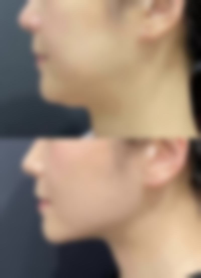 二、成都艺美汇整形医疗美容医院怎么样？