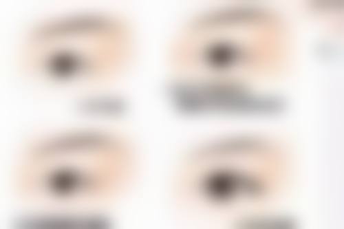 {丰太阳穴怎样是比较安全的？参考穴位知识助力安全丰太阳穴达成理想效果 