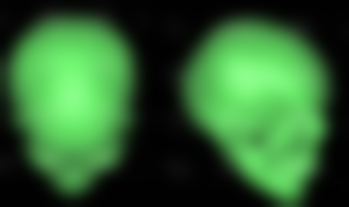 四、丰太阳穴的好处