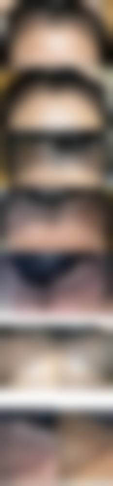 九、兰州梦艺霖医疗美容门诊部真实的患者评价