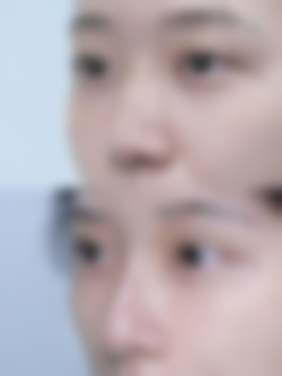 四、兰州梦艺霖医疗美容门诊部特色项目