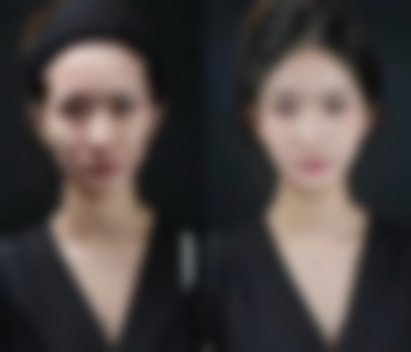 二、佛山伊万卡医疗美容门诊部怎么样？