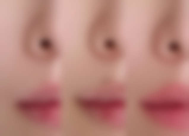 三、兰州梦艺霖医疗美容门诊部诊疗项目有哪些？