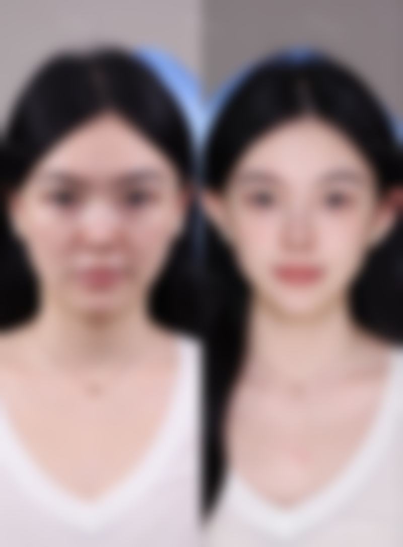 三、针对性医美改善方案