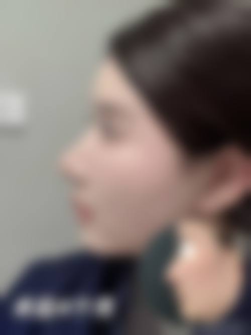 五、上海华澳整形美容门诊部价格表