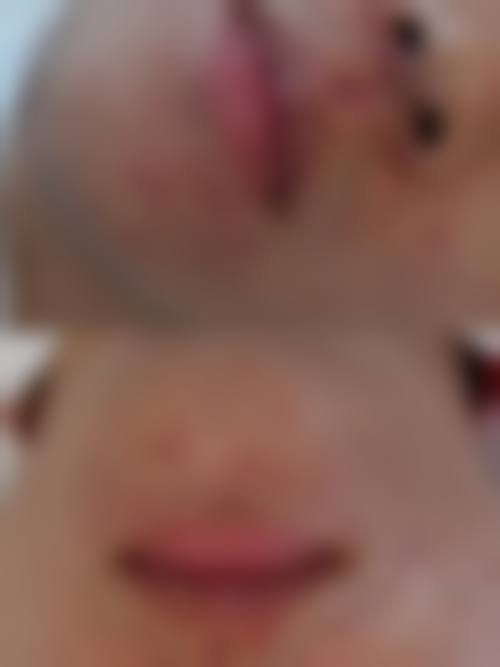 三、尹泰皖技术优势