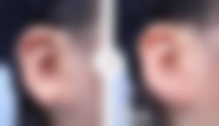 八、山东西子医疗美容门诊部真实的患者评价