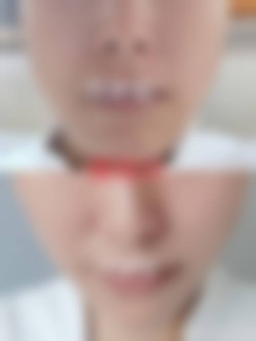 八、泰州丽都整形医疗美容医院真实的患者评价