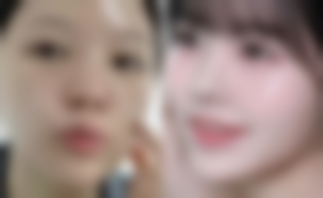 六、选择专精医生和正规机构对确定瘦脸针打一次多少个单位的重要性