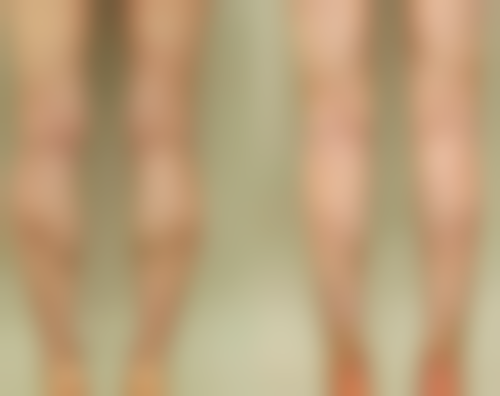 一、疤痕疙瘩的形成与危害