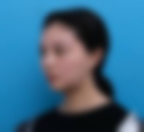 四、重庆昆明朱云华整形医疗美容诊所特色项目