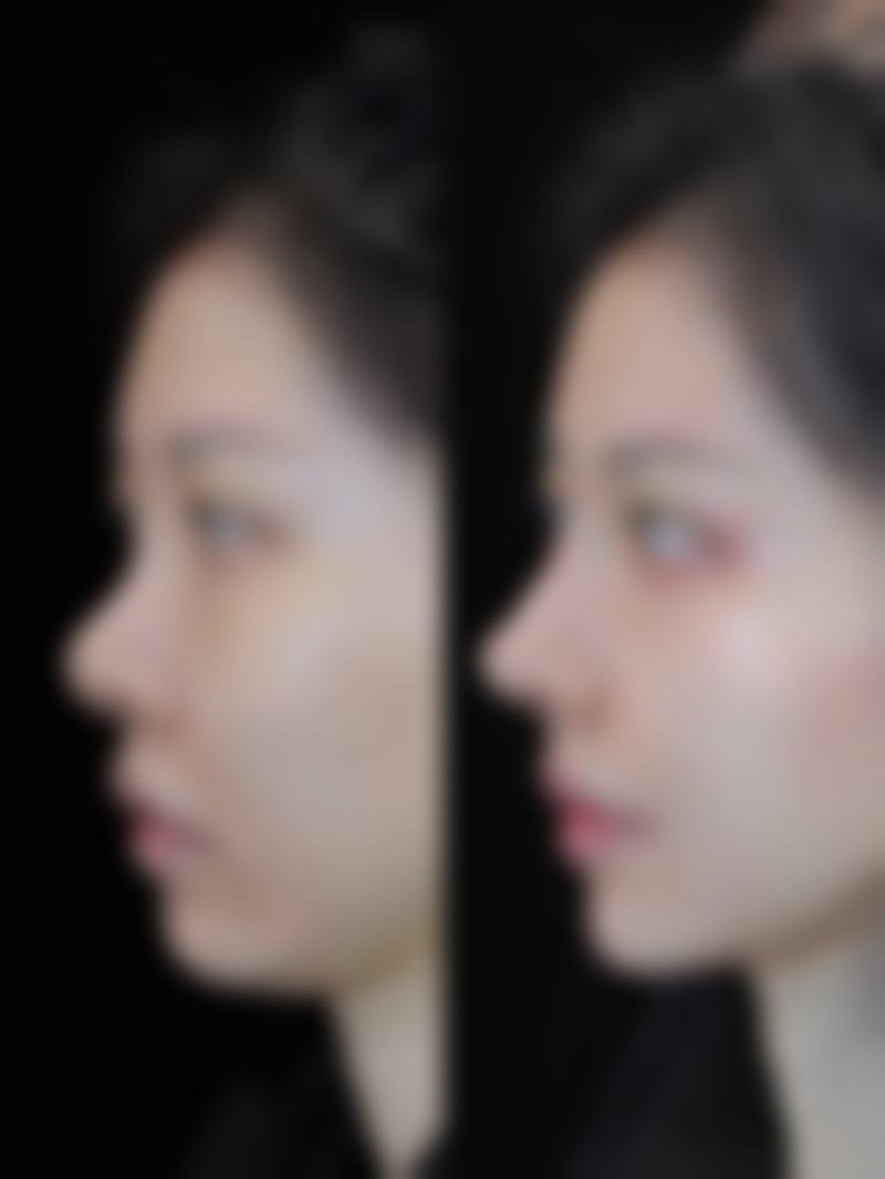 八、重庆孙林医疗美容诊所真实的患者评价