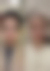 {狐狸眼割双眼皮要开眼角吗？从眼部条件和审美目标分析，附真实案例图片参考 