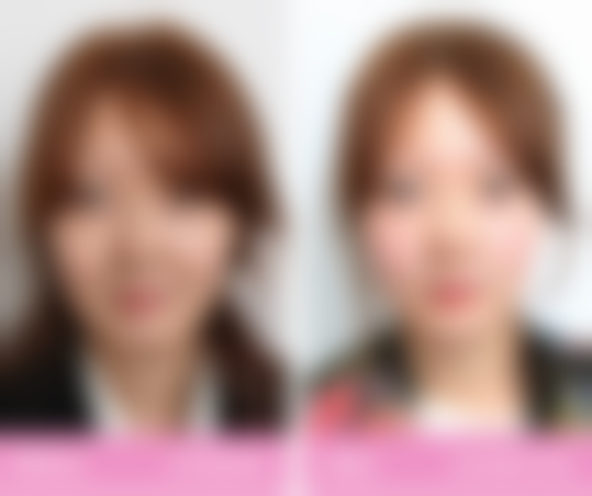 三、韩国陈整形外科医院诊疗项目有哪些？