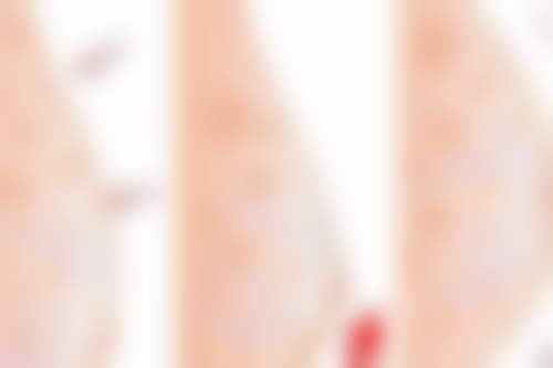 四、湖州心悦医疗美容门诊部特色项目