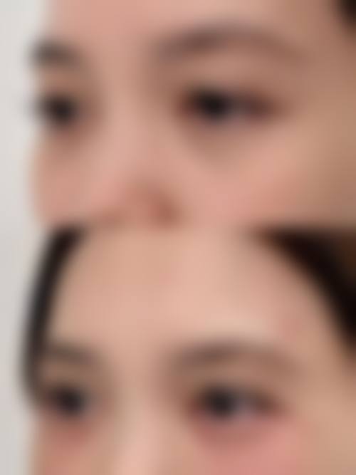 五、广州雅贝壹整形医院价格表