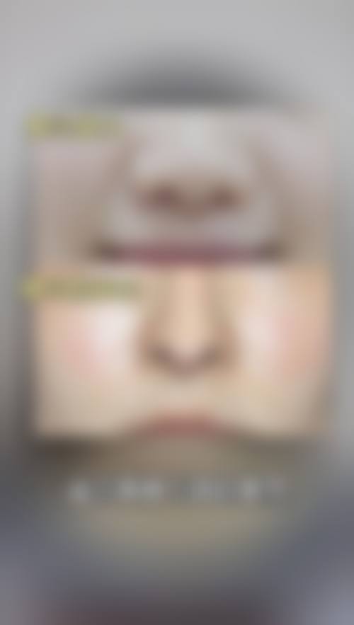 九、重庆市惠美医疗美容诊所真实的患者评价