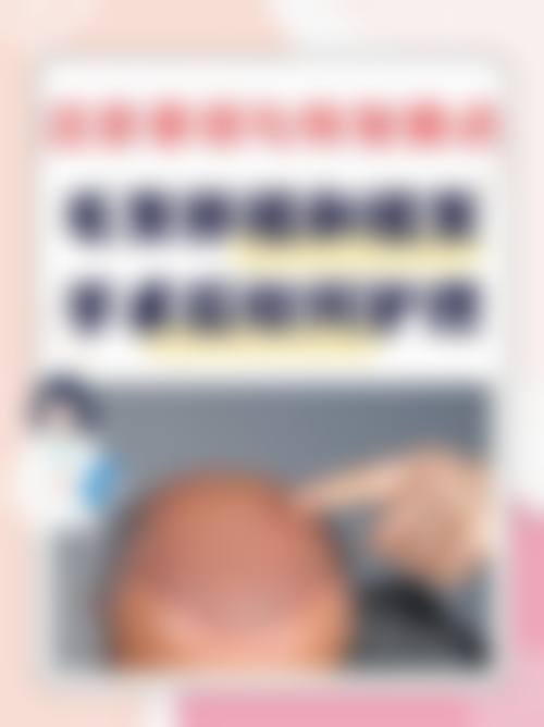 四、怀化曹家医疗美容有限公司特色项目