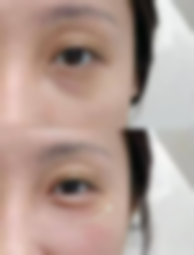 二、不同修复阶段与注意事项