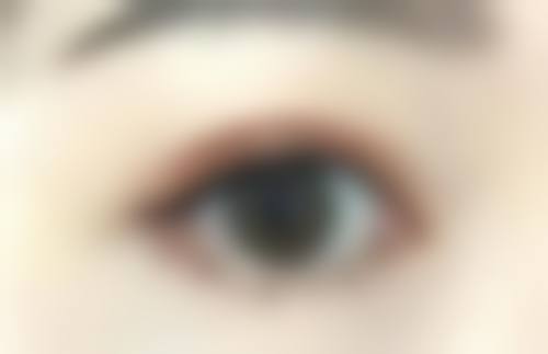 八、晋城俏丽整形美容医院真实的患者评价