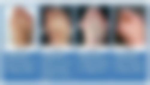 二、隆胸后疼痛情况分析