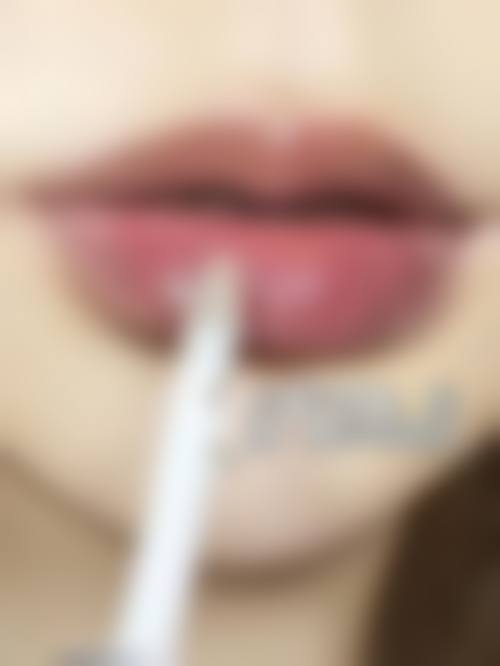 八、遵义春草世纪植发医院真实的患者评价