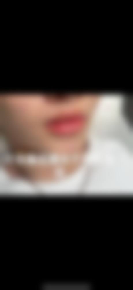 二、遵义春草世纪植发医院怎么样？