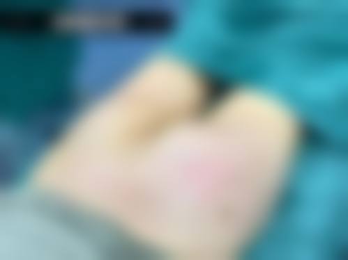 八、合肥美之星整医疗美容医院真实的患者评价