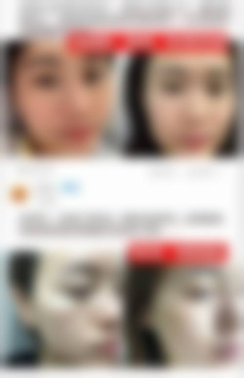 三、中山新时肌医疗美容诊所诊疗项目有哪些？