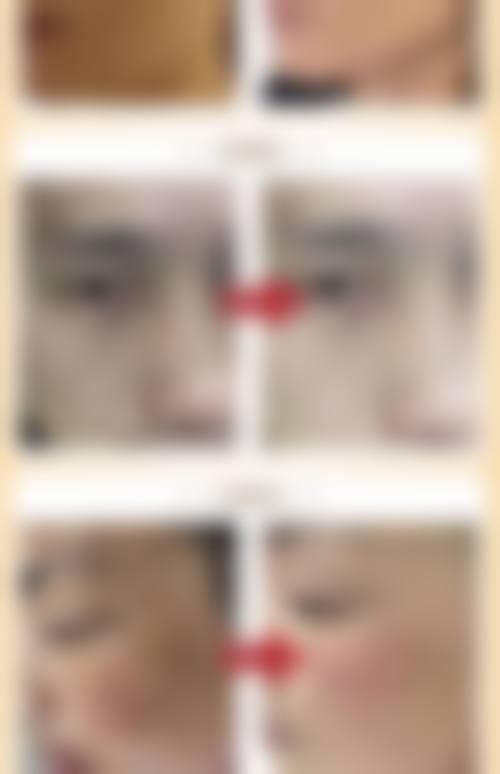 四、中山新时肌医疗美容诊所特色项目