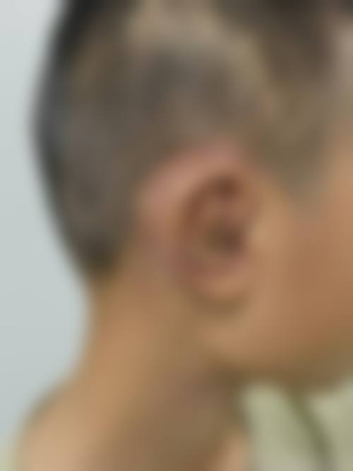 五、中山新时肌医疗美容诊所价格表