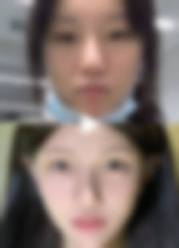 二、祛疤膏选择的关键成分