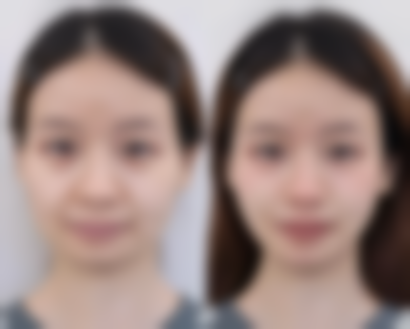 二、什么眼霜可以淡化眼袋：常见有效成分的眼霜推荐