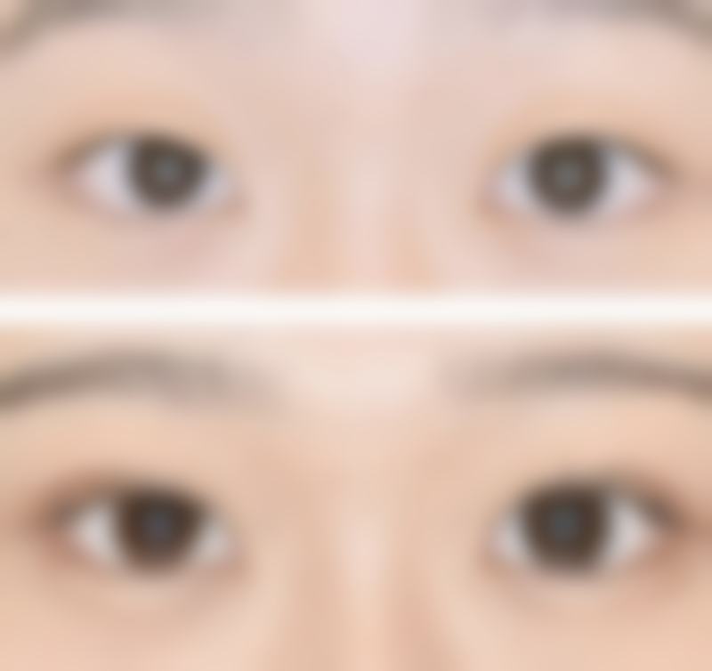 八、沧州枫华整形医院真实的患者评价