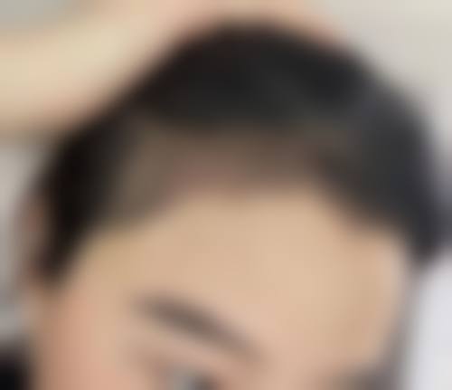 六、武汉雍禾植发美度医疗美容门诊部价格表