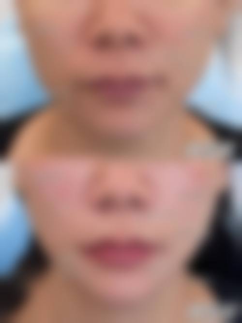 七、福州文华美容皮肤科诊所预约方式