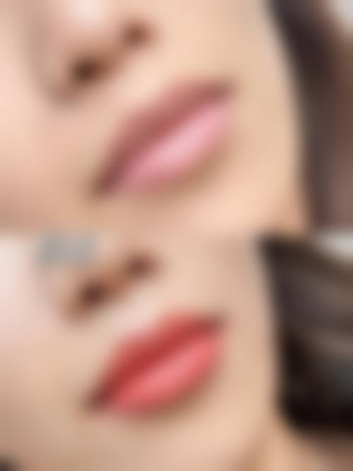 四、武汉雍禾植发美度医疗美容门诊部特色项目