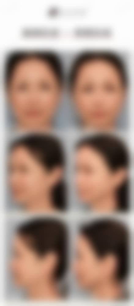 九、南华大学附属前列医院整形科真实的患者评价