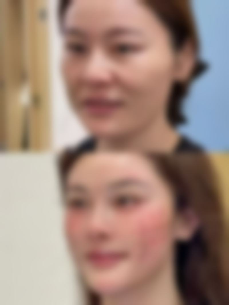 四、福州文华美容皮肤科诊所特色项目