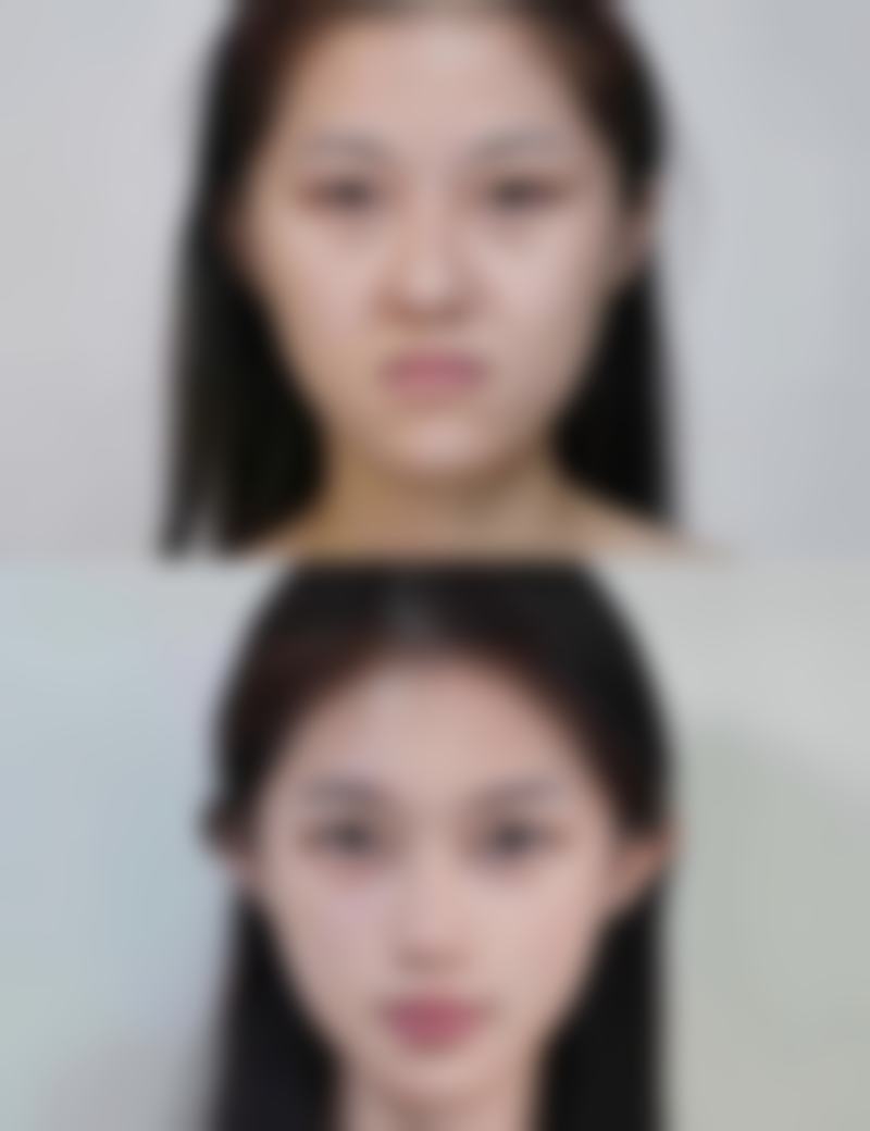 九、武汉雍禾植发美度医疗美容门诊部真实的患者评价