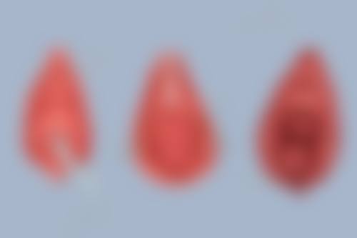 二、去疤膏的作用机制