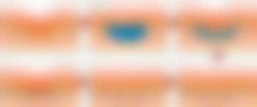 三、不同地区割双眼皮的价格实例