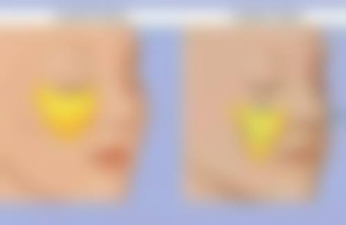 五、日常护理注意事项