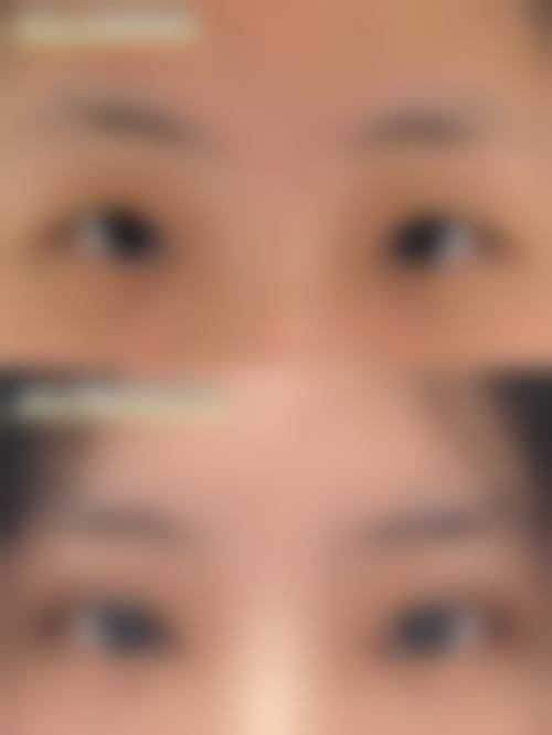 八、南昌妆典整形医院真实的患者评价