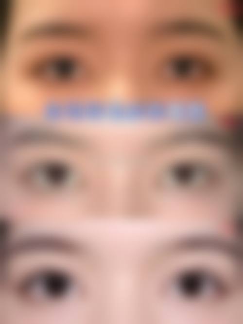 八、宿迁天黛医疗美容真实的患者评价