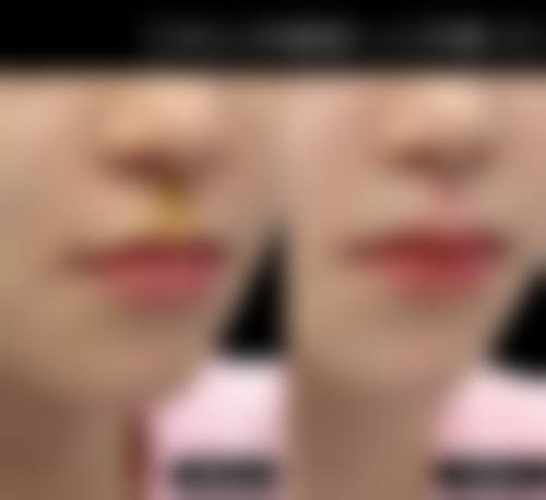 七、深圳美源医疗美容预约方式