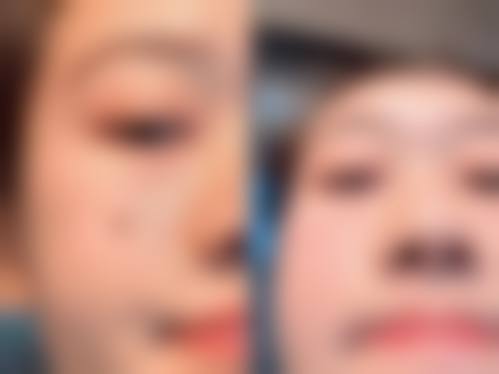 四、深圳美源医疗美容特色项目